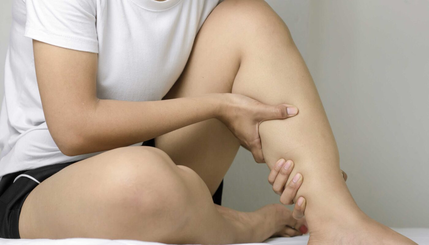 Lipedema en las piernas y sus principales síntomas